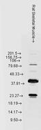 Heat Shock Protein Family B (Small) Member 8 antibody, LS-C109063, Lifespan Biosciences, Western Blot image 