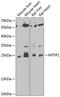 Mitochondrial fission process protein 1 antibody, 22-707, ProSci, Western Blot image 