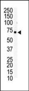 EPH Receptor B6 antibody, PA5-14615, Invitrogen Antibodies, Western Blot image 