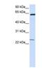 Transmembrane Protein 138 antibody, NBP1-59523, Novus Biologicals, Western Blot image 