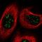 TBC1 Domain Family Member 13 antibody, NBP1-92477, Novus Biologicals, Immunofluorescence image 