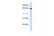 DDB1 And CUL4 Associated Factor 11 antibody, GTX46981, GeneTex, Western Blot image 