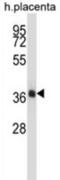 NK2 Homeobox 4 antibody, abx027858, Abbexa, Western Blot image 