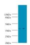 SPT3 Homolog, SAGA And STAGA Complex Component antibody, LS-C317658, Lifespan Biosciences, Western Blot image 