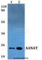 Aralkylamine N-Acetyltransferase antibody, LS-C411724, Lifespan Biosciences, Western Blot image 
