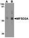 Major Facilitator Superfamily Domain Containing 2A antibody, A33936, Boster Biological Technology, Western Blot image 