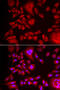 Bleomycin Hydrolase antibody, 22-293, ProSci, Immunofluorescence image 