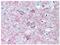 Adenosine A2a Receptor antibody, AM12133PU-N, Origene, Immunohistochemistry paraffin image 