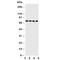 P21 (RAC1) Activated Kinase 6 antibody, R30819, NSJ Bioreagents, Western Blot image 