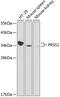 Serine Protease 1 antibody, A01637-1, Boster Biological Technology, Western Blot image 