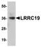 Leucine Rich Repeat Containing 19 antibody, A15663, Boster Biological Technology, Western Blot image 