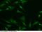 UMP-CMP kinase antibody, 14258-MM07, Sino Biological, Immunohistochemistry paraffin image 