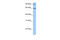 Zinc Finger Protein 449 antibody, 27-530, ProSci, Western Blot image 