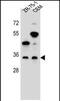 Glycoprotein M6B antibody, PA5-71592, Invitrogen Antibodies, Western Blot image 