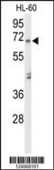 Amylase Alpha 1C (Salivary) antibody, MBS9211378, MyBioSource, Western Blot image 