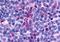 C-C chemokine receptor type 8 antibody, orb79883, Biorbyt, Immunohistochemistry paraffin image 