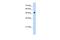 Septin 6 antibody, PA5-42833, Invitrogen Antibodies, Western Blot image 