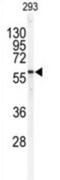 Serine Palmitoyltransferase Long Chain Base Subunit 1 antibody, abx031623, Abbexa, Western Blot image 