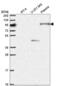 Nucleolar Protein With MIF4G Domain 1 antibody, NBP2-58765, Novus Biologicals, Western Blot image 