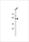 Fucosyltransferase 8 antibody, LS-C166287, Lifespan Biosciences, Western Blot image 