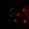 Nuclear Receptor Subfamily 2 Group E Member 1 antibody, abx142107, Abbexa, Western Blot image 
