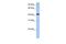 UDP-GlcNAc:BetaGal Beta-1,3-N-Acetylglucosaminyltransferase 7 antibody, GTX46142, GeneTex, Western Blot image 