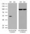 RAD23 Homolog B, Nucleotide Excision Repair Protein antibody, LS-C790415, Lifespan Biosciences, Western Blot image 