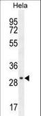 EMG1 N1-Specific Pseudouridine Methyltransferase antibody, LS-C167747, Lifespan Biosciences, Western Blot image 