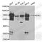 Endoglin antibody, A5639, ABclonal Technology, Western Blot image 
