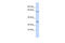 Probable E3 ubiquitin-protein ligase TRIM8 antibody, 25-217, ProSci, Western Blot image 