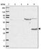 ST8 Alpha-N-Acetyl-Neuraminide Alpha-2,8-Sialyltransferase 4 antibody, PA5-62324, Invitrogen Antibodies, Western Blot image 