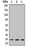 UCK 2 antibody, LS-C668194, Lifespan Biosciences, Western Blot image 