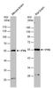 FYN Proto-Oncogene, Src Family Tyrosine Kinase antibody, PA5-28975, Invitrogen Antibodies, Western Blot image 