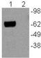 Nuclear Receptor Subfamily 4 Group A Member 1 antibody, 14-5965-82, Invitrogen Antibodies, Western Blot image 