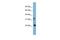 Crystallin Beta B3 antibody, GTX45811, GeneTex, Western Blot image 