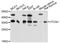 V-Set Domain Containing T Cell Activation Inhibitor 1 antibody, abx126789, Abbexa, Western Blot image 