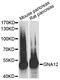 G Protein Subunit Alpha 12 antibody, 15-178, ProSci, Western Blot image 