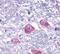 Parathyroid Hormone 2 Receptor antibody, PA5-34133, Invitrogen Antibodies, Immunohistochemistry paraffin image 