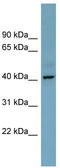 Chromosome X Open Reading Frame 66 antibody, TA336103, Origene, Western Blot image 