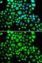 B Cell Receptor Associated Protein 31 antibody, GTX65823, GeneTex, Immunofluorescence image 