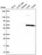 FYN Proto-Oncogene, Src Family Tyrosine Kinase antibody, NBP2-57212, Novus Biologicals, Western Blot image 