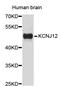 Potassium Voltage-Gated Channel Subfamily J Member 12 antibody, STJ24297, St John
