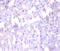 Angiogenin antibody, LS-C212028, Lifespan Biosciences, Immunohistochemistry paraffin image 