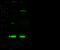 Core-Binding Factor Subunit Beta antibody, 101203-T34, Sino Biological, Western Blot image 