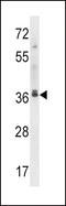 Microtubule Associated Protein RP/EB Family Member 2 antibody, LS-C164031, Lifespan Biosciences, Western Blot image 