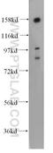 Nucleolar Protein 8 antibody, 12043-1-AP, Proteintech Group, Western Blot image 