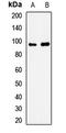 Sortilin 1 antibody, LS-C668404, Lifespan Biosciences, Western Blot image 