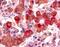 Arginine Vasopressin Receptor 1B antibody, NLS3739, Novus Biologicals, Immunohistochemistry paraffin image 