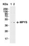 Transmembrane Protein 173 antibody, 5269, ProSci, Western Blot image 