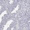 Small Integral Membrane Protein 2 antibody, PA5-55454, Invitrogen Antibodies, Immunohistochemistry paraffin image 